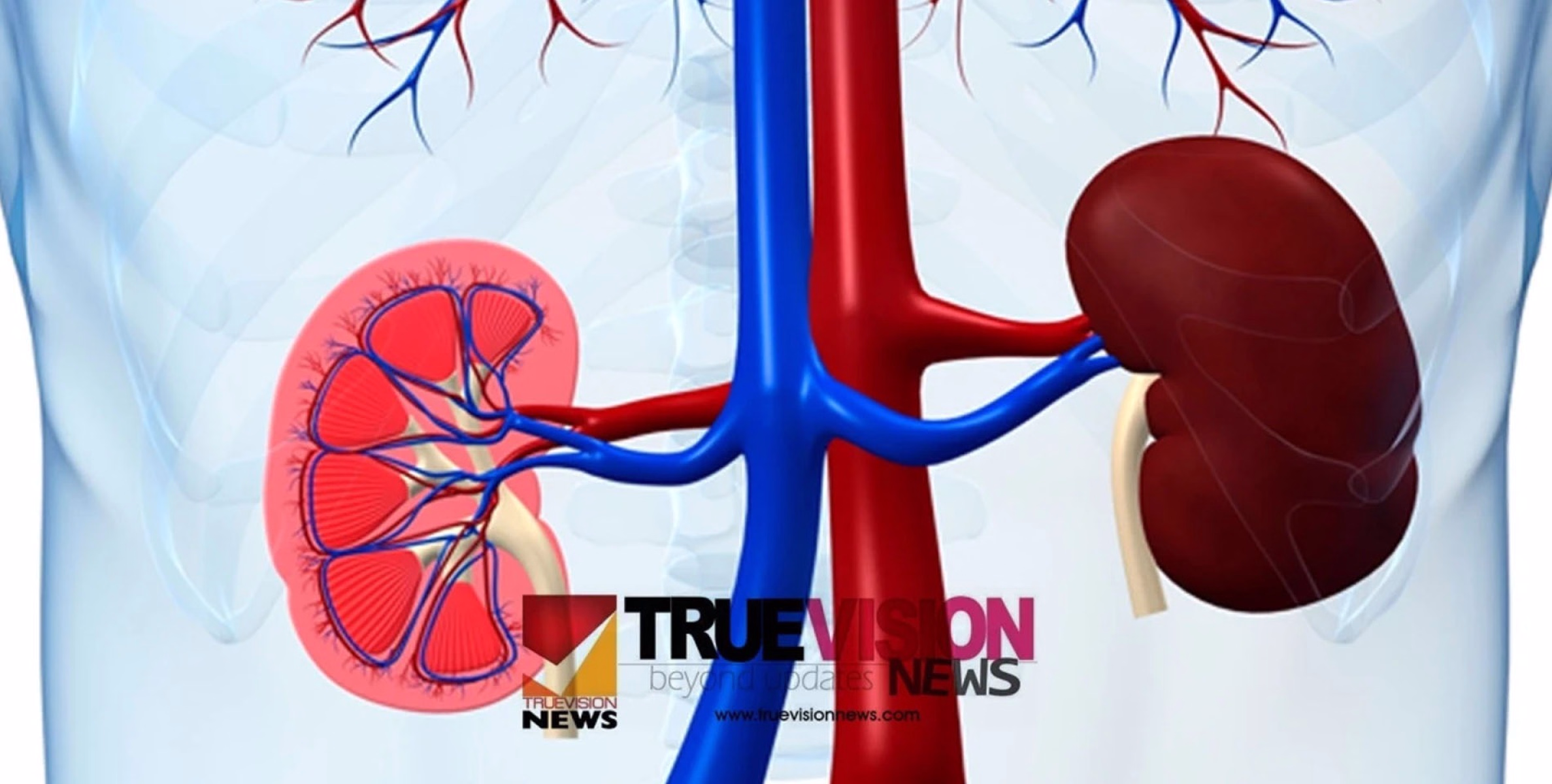 യൂറോളജി വിഭാഗം; ഡോ: പങ്കജിൻ്റെ സേവനം വടകര സിഎം ഹോസ്പിറ്റലിൽ ലഭ്യമാണ്