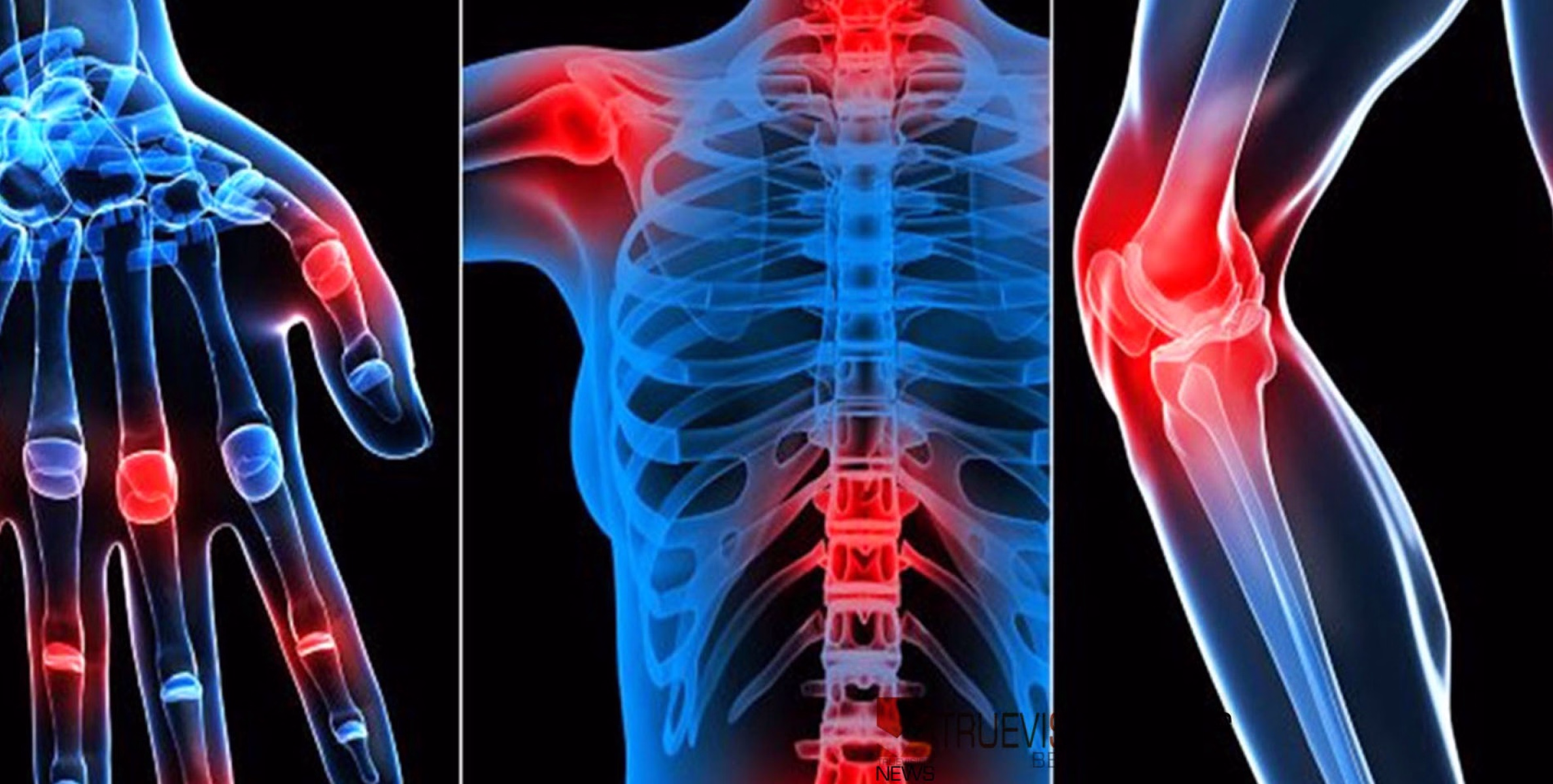 #parco |റുമറ്റോളജി വിഭാഗം:വടകര പാർകോയിൽ ഡോ: ബബിത മേക്കയിലിന്റെ സേവനം എല്ലാ ബുധനാഴ്ചകളിലും