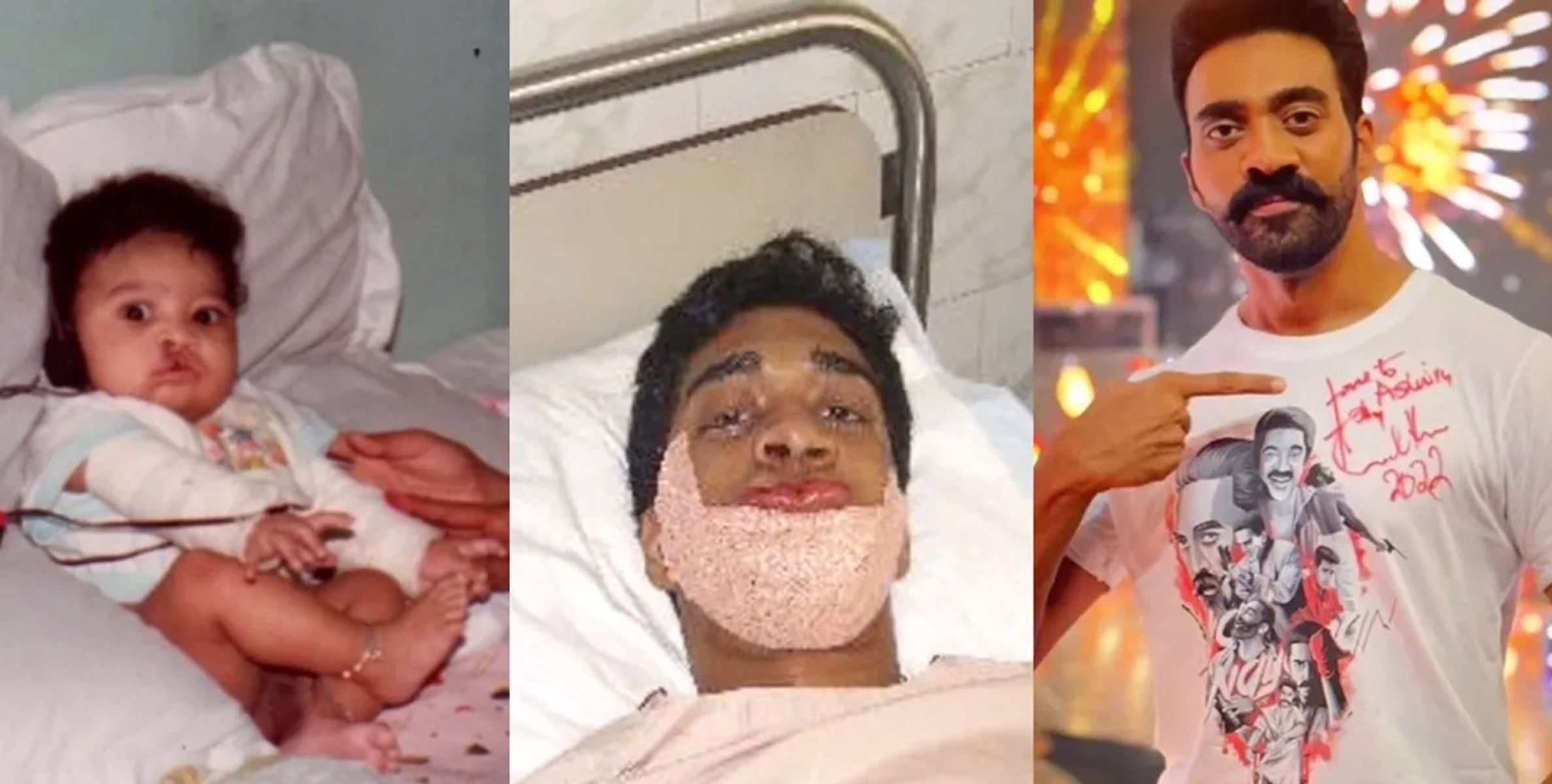 #Ashwin | സർജറികളിലൂടെയുള്ള എന്റെ യാത്ര തുടങ്ങുന്നത് മൂന്നുമാസം പ്രായമുള്ളപ്പോൾ - അശ്വിൻ 