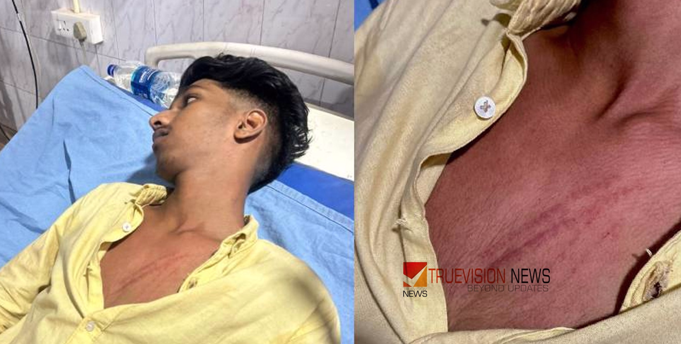 സ്പോർട്സ് ഡേ അലങ്കോലമാക്കി...; പേരാമ്പ്ര  സി.കെ.ജി കോളേജിൽ എസ്.എഫ്.ഐ പ്രവർത്തകർക്ക് നേരെ ആക്രമണം; യൂണിറ്റ് സെക്രട്ടറിക്ക് പരിക്ക്