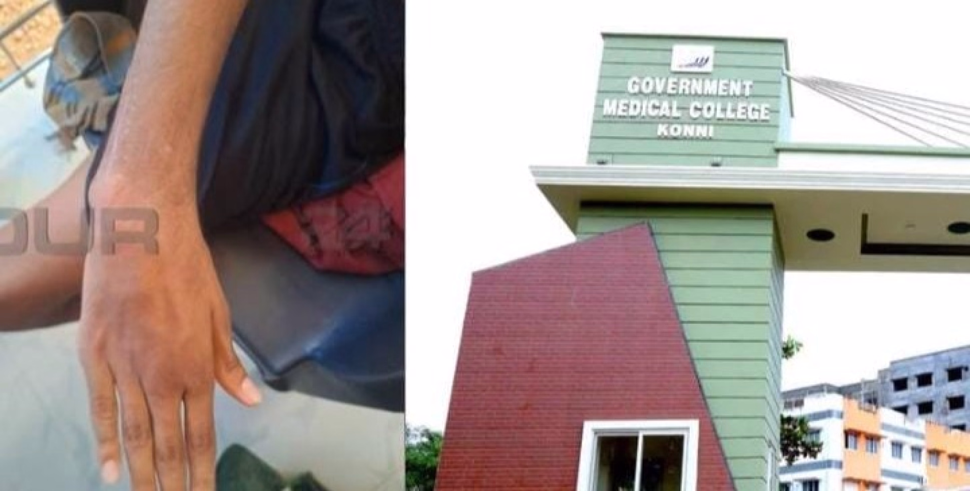 കോന്നി മെഡിക്കൽ കോളജിൽ ചികിത്സ പിഴവെന്ന് പരാതി; ശസ്ത്രക്രിയക്ക് പിന്നാലെ 14കാരന്റെ ഒടിഞ്ഞ കൈ വളഞ്ഞുപോയി